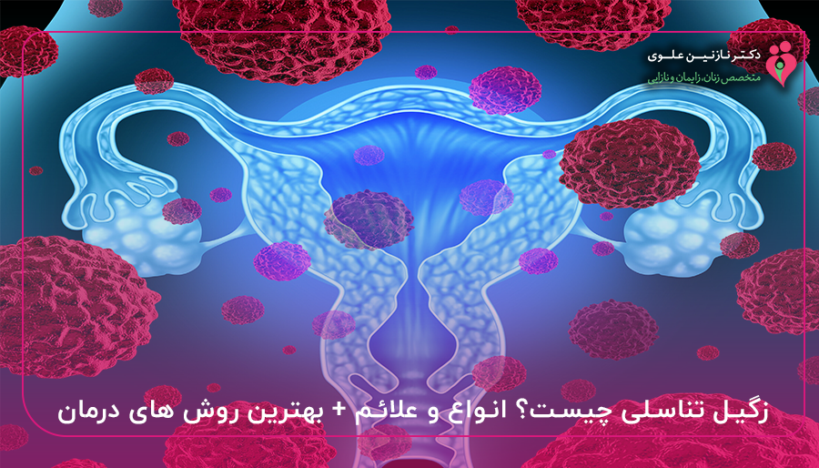 زگیل تناسلی چیست؟ انواع و علائم + بهترین روش های درمان