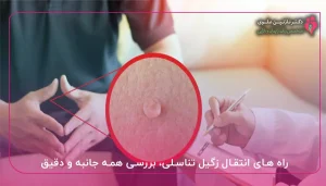 راه‌ های انتقال زگیل تناسلی، بررسی همه جانبه و دقیق