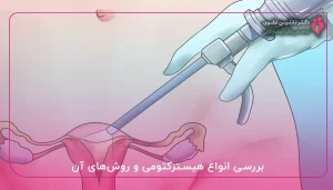 بررسی انواع هیسترکتومی و روشهای آن
