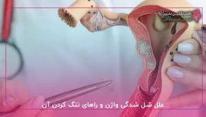 راهای تنگ کردن واژن