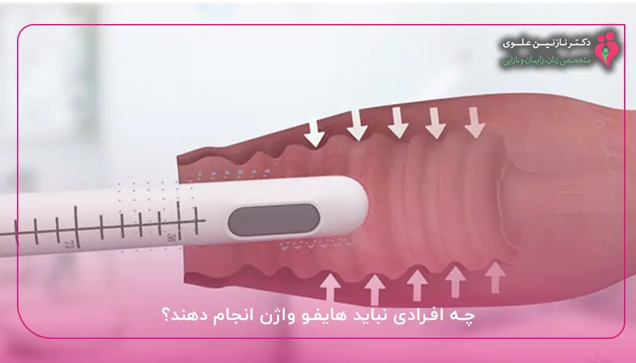 چه افرادی نباید هایفو واژن انجام دهند؟