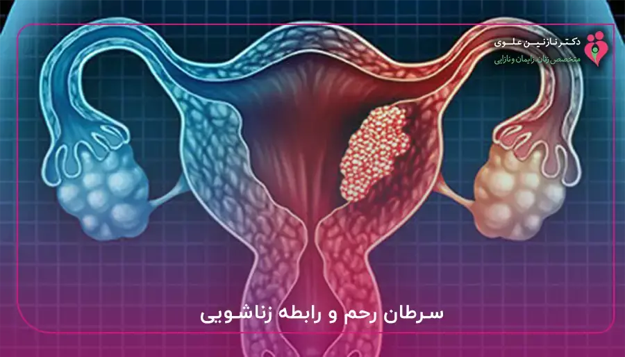 سرطان رحم و رابطه زناشویی
