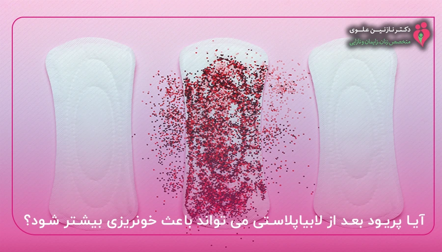 آیا پریود بعد از لابیاپلاستی می تواند باعث خونریزی بیشتر شود؟