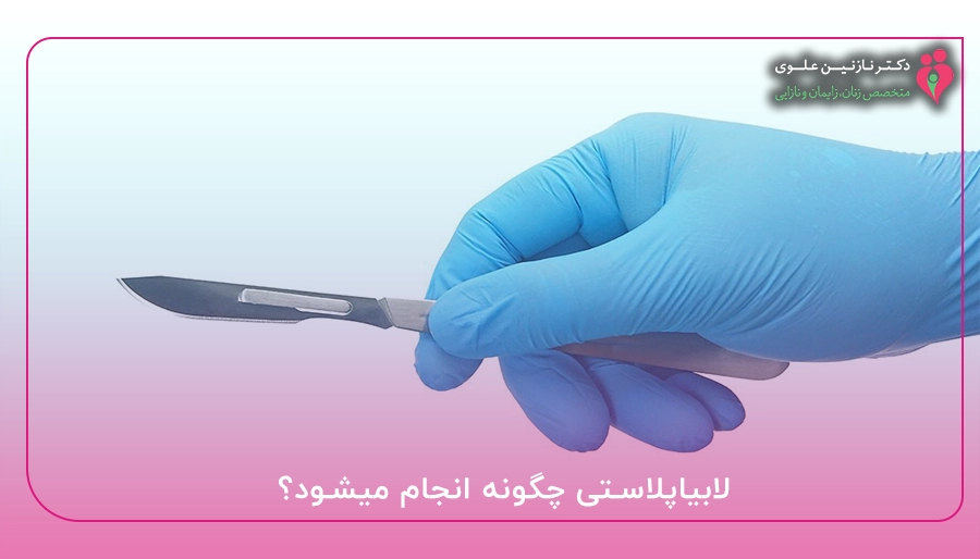 لابیاپلاستی چگونه انجام میشود؟