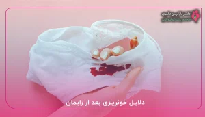 دلایل خونریزی بعد از زایمان