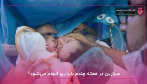 سزارین در هفته چندم بارداری انجام می_شود؟