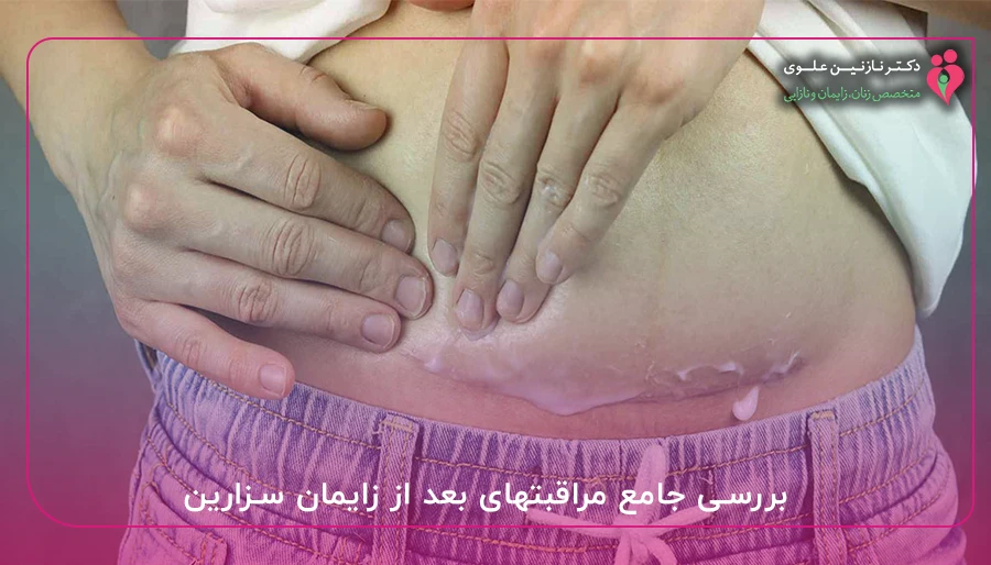 بررسی جامع مراقبتهای بعد از زایمان سزارین