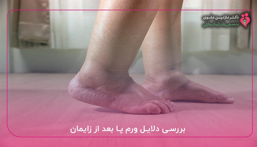 بررسی دلایل ورم پا بعد از زایمان