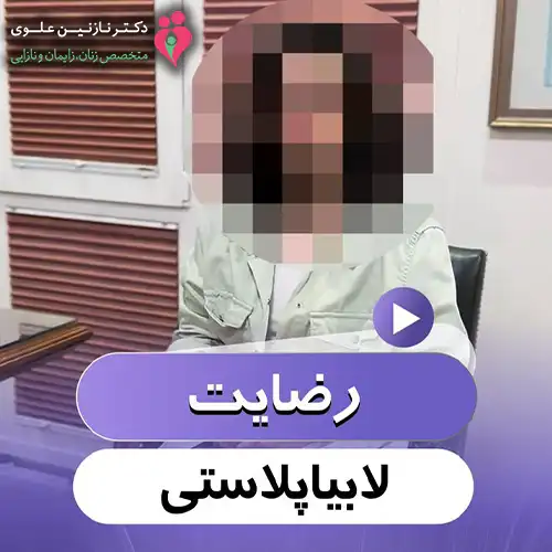 رضایت زیباجو لابیاپلاستی