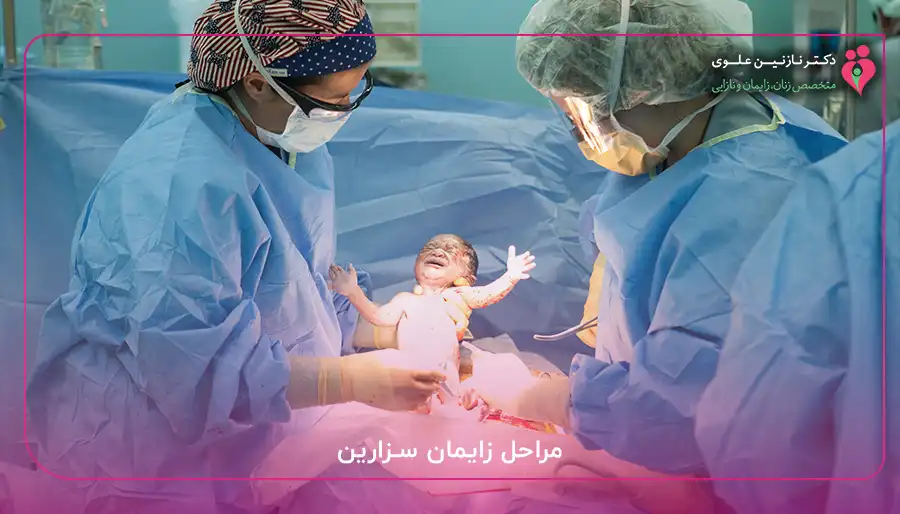 مراحل زایمان سزارین