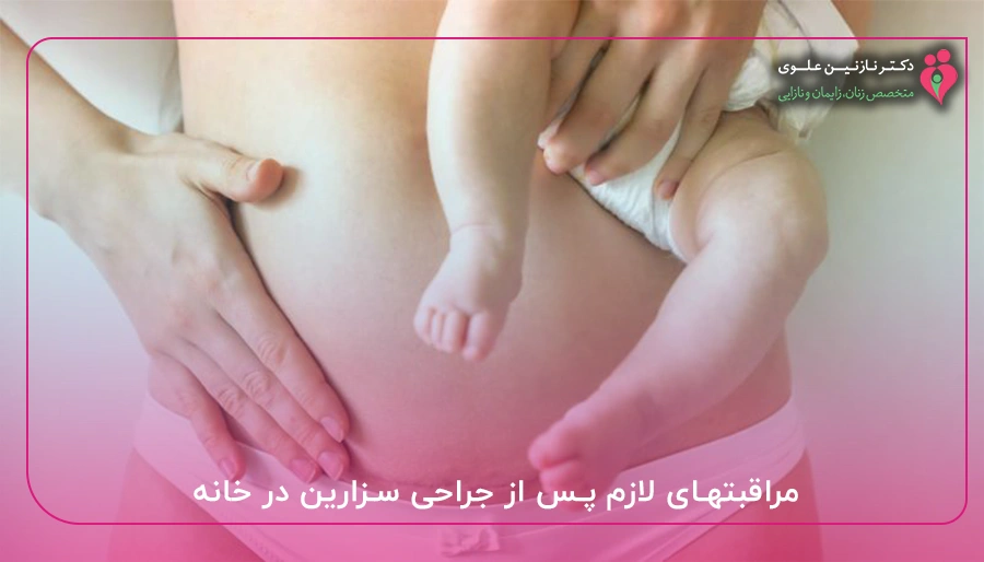 مراقبتهای لازم پس از جراحی سزارین در خانه