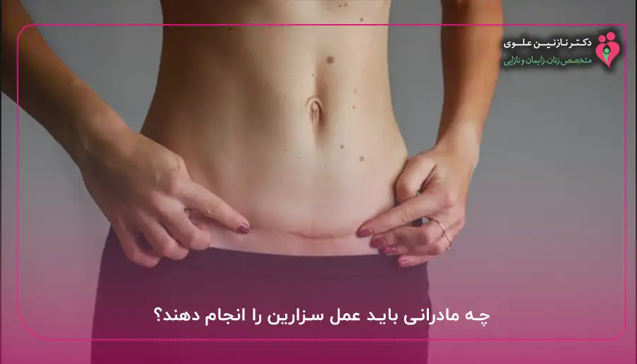 چه مادرانی باید عمل سزارین را انجام دهند؟