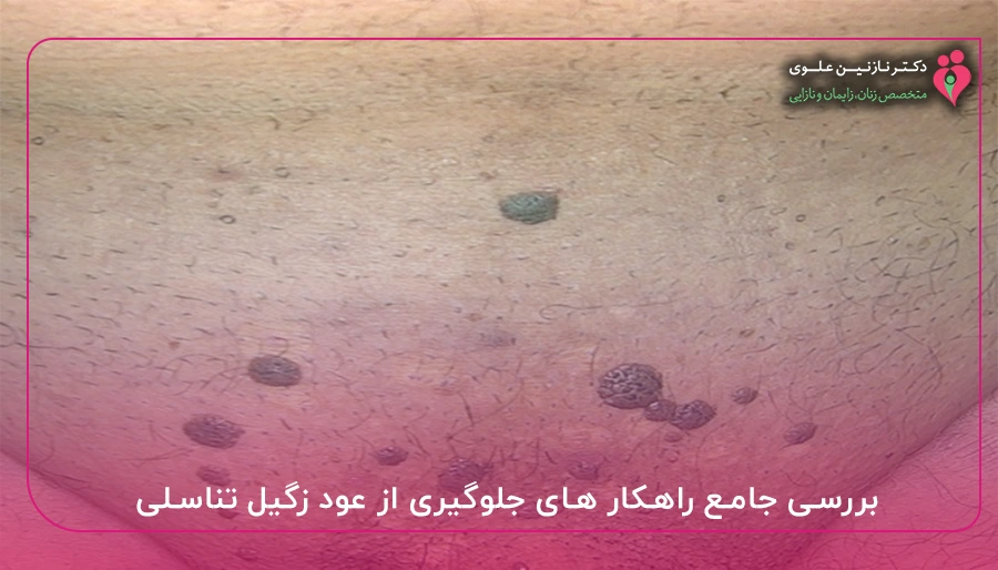 بررسی جامع راهکار های جلوگیری از عود زگیل تناسلی