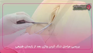 بررسی مراحل تنگ کردن واژن بعد از زایمان طبیعی