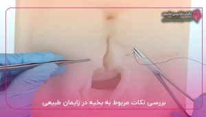 بررسی نکات مربوط به بخیه در زایمان طبیعی