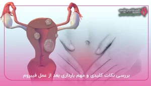 بررسی نکات کلیدی و مهم بارداری بعد از عمل فیبروم