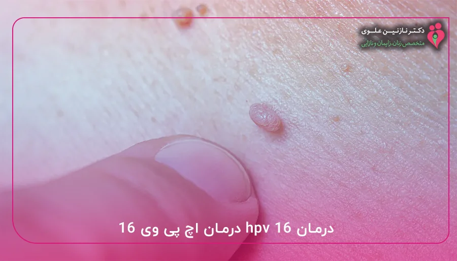 درمان hpv 16 درمان اچ پی وی ۱۶