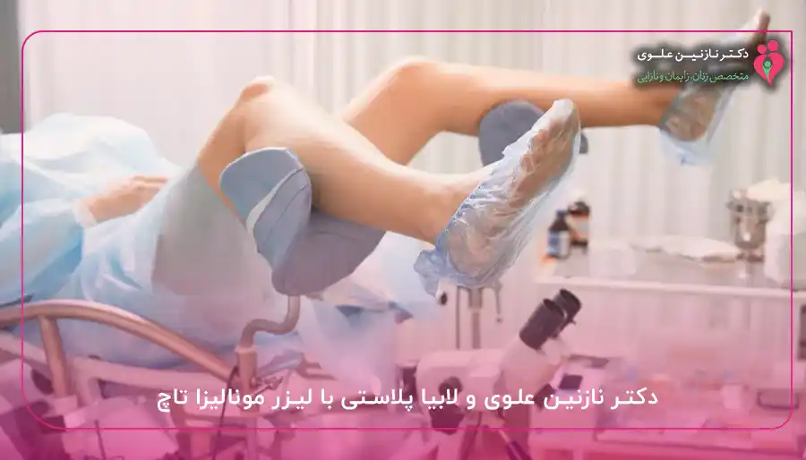 دکتر نازنین علوی و لابیا پلاستی با لیزر مونالیزا تاچ