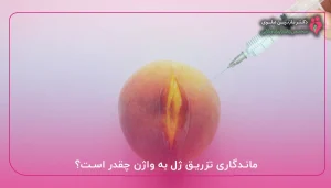 ماندگاری تزریق ژل به واژن چقدر است؟