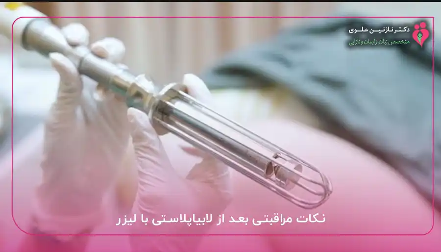 نکات مراقبتی بعد از لابیاپلاستی با لیزر