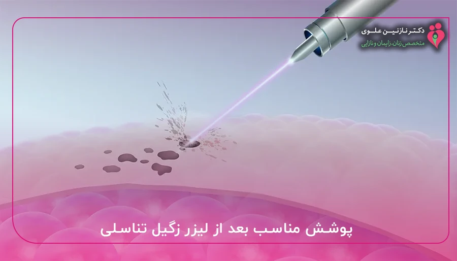 پوشش مناسب بعد از لیزر زگیل تناسلی