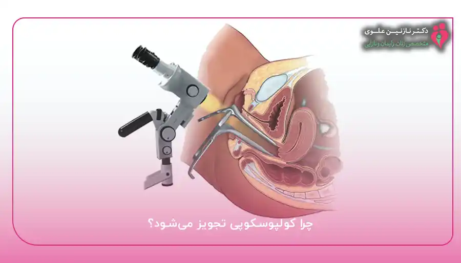 چرا کولپوسکوپی تجویز می‌شود؟